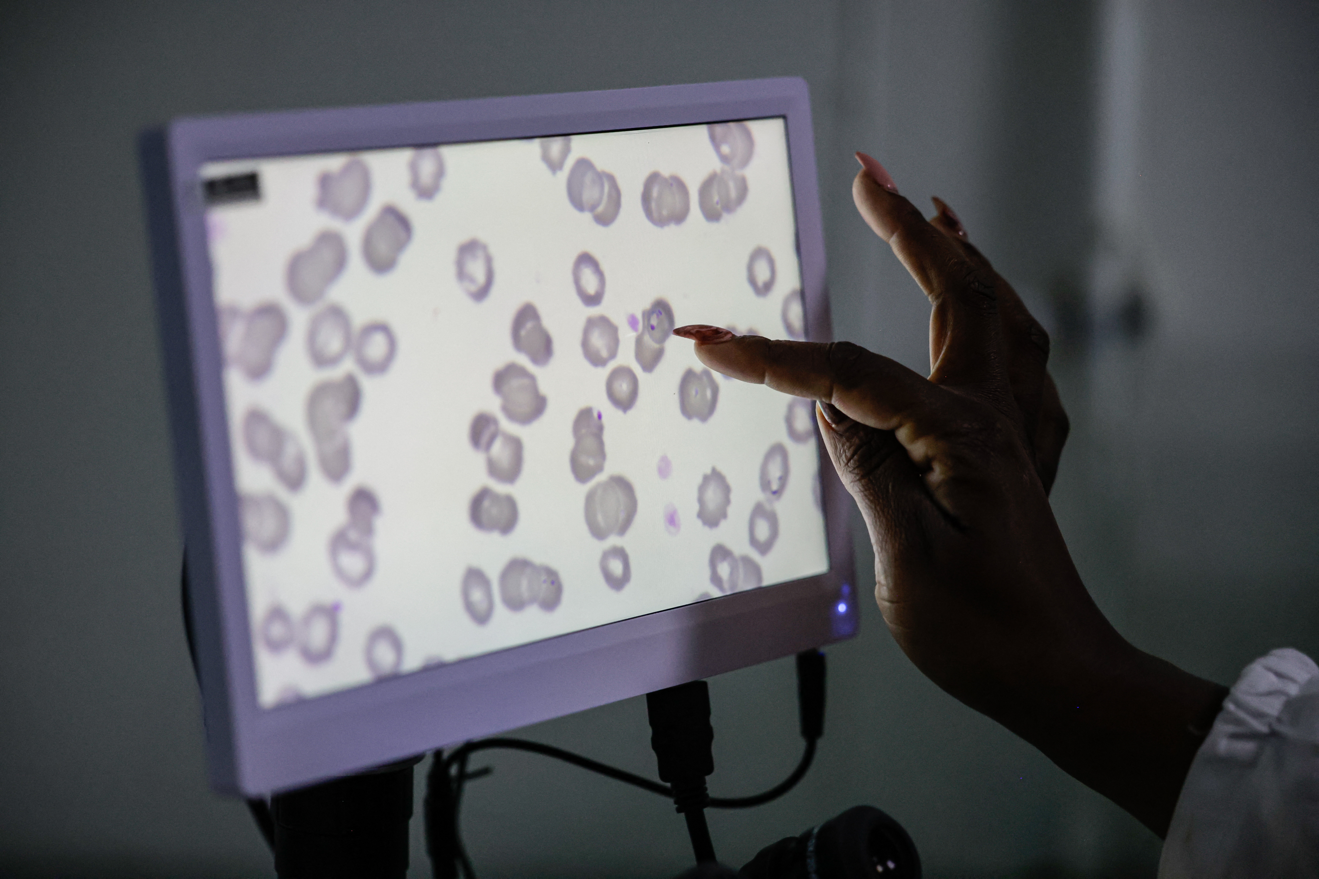 As climate shifts, malaria gains ground in southern Africa